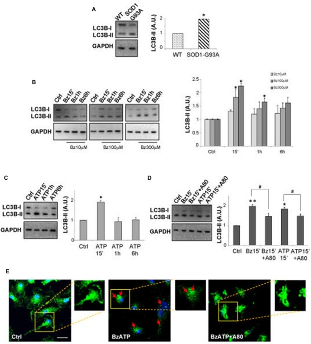 P2X7 activation modulates microtubule-associated protein 1 light chain 3 (LC3)-II in superoxide dismutase 1 (SOD1)-G93A microglia. Front Cell Neurosci. 2017 Aug 21;11:249.