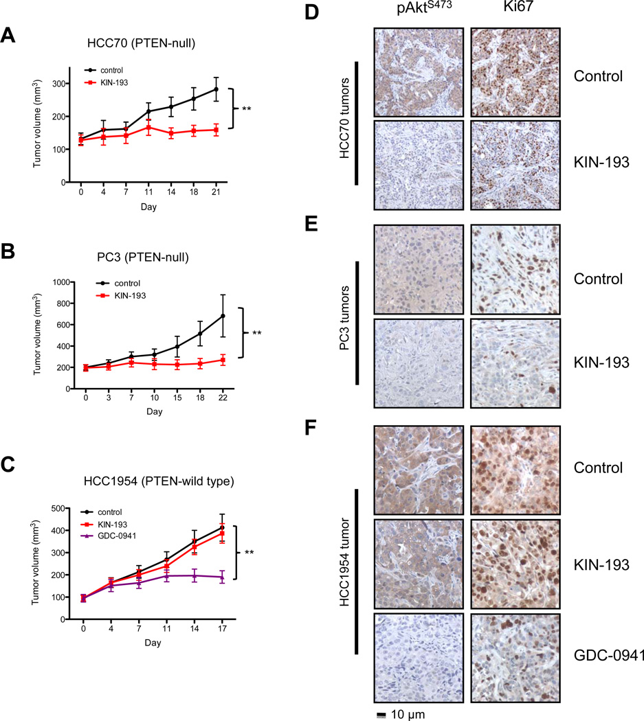 In vivo effect of KIN-193 on PTEN-deficient tumors. Cancer Discov. 2012 May;2(5):425-33.