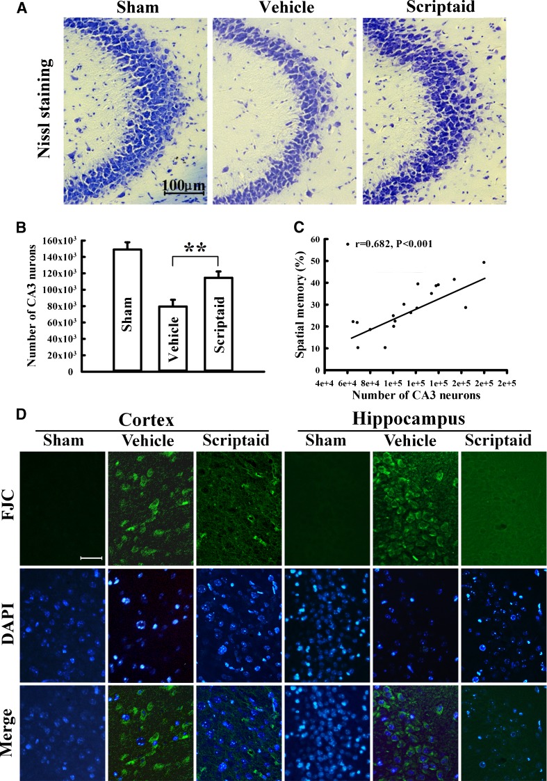 Scriptaid prevented neurodegeneration in cortex and hippocampus. Neurotherapeutics. 2013 Jan;10(1):124-42.