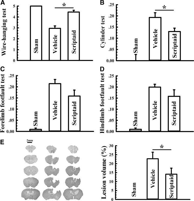 Scriptaid conferred comparable protection when administrated 12 h post-controlled cortical impact at day 7 after injury. Neurotherapeutics.2013 Jan;10(1):124-42.