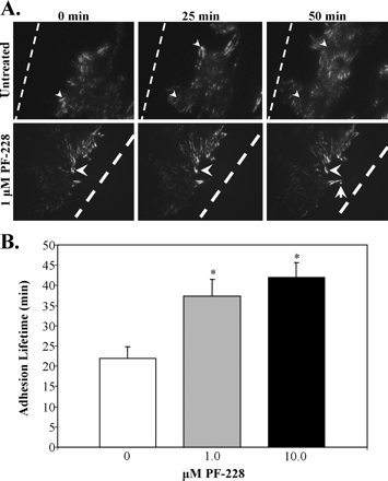 Effect of PF-228 on focal adhesion turnover. J Biol Chem. 2007 May 18;282(20):14845-52.