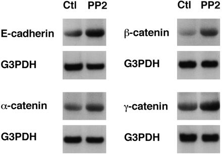 Northern blot analysis of E-cadherin/catenin complex in HT29 cells with or without PP2. Clin Cancer Res. 2002 Jul;8(7):2430-6.