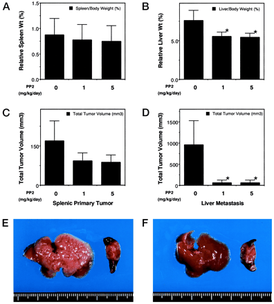 The effect of PP2 on splenic primary tumor and liver metastasis. Clin Cancer Res. 2002 Jul;8(7):2430-6.