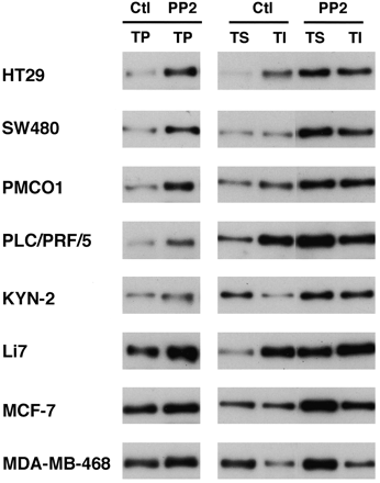 Immunoblot analysis of the expression and distribution of E-cadherin in cancer cells with or without PP2. Clin Cancer Res. 2002 Jul;8(7):2430-6.