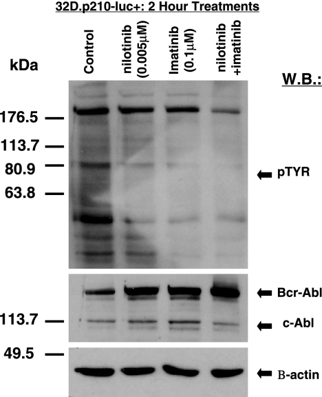 Inhibition of cellular tyrosine phosphorylation in BCR-ABL–expressing cells by imatinib and nilotinib, combined. Blood. 2007 Mar 1;109(5):2112-20.