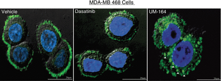 Altered localization of c-Src when bound by UM-164. Representative fluorescence microscopy images of MDA-MB 468 cells treated with vehicle (DMSO), 5 μmol/L dasatinib, or 5 μmol/L UM-164 for 4 hours. In the vehicle-treated cells, c-Src (green) is predominately localized to the cell membranes. UM-164–treated cells show cytoplasmic punctate structures indicated by the white triangles. Nuclei are stained in blue (DAPI). Scale bar, 20 μm. Clin Cancer Res. 2016 Oct 15;22(20):5087-5096.