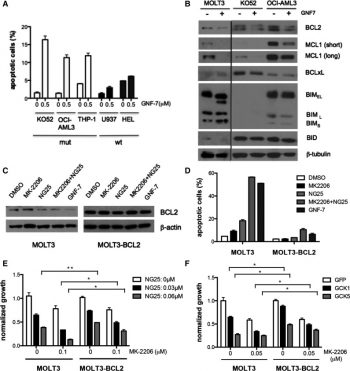 Effect of GNF-7 suppression of AKT and/or GCK on induction of apoptosis and cell cycle. Blood. 2015 May 14; 125(20): 3133–3143.