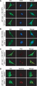 GNF-2 induces translocation of the myristoylated c-Abl to the ER. J Biol Chem.2009 Oct 16;284(42):29005-14.