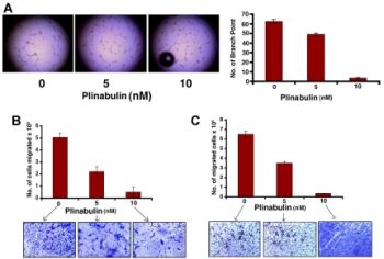 Antivascular activity of plinabulin. Blood. 2011 May 26;117(21):5692-700.