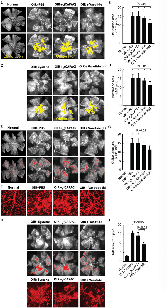 Effects of Vasotide on the vasculature and tuft formation in ROP mice. Sci Transl Med. 2015 Oct 14;7(309):309ra165.