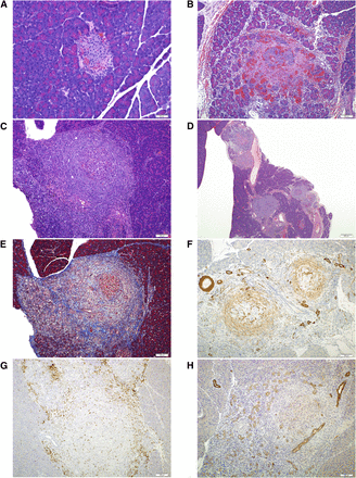 Representative photomicrographs of pancreatic histopathology observed in Sprague-Dawley rats following daily oral administration of GDC-0853 for 21 or 28 days are presented. J Pharmacol Exp Ther. 2017 Jan;360(1):226-238.