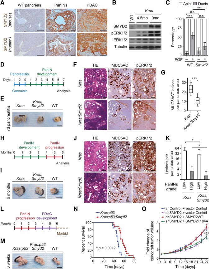 SMYD2 promotes Ras-driven pancreatic cancer. Genes Dev. 2016 Apr 1;30(7):772-85.