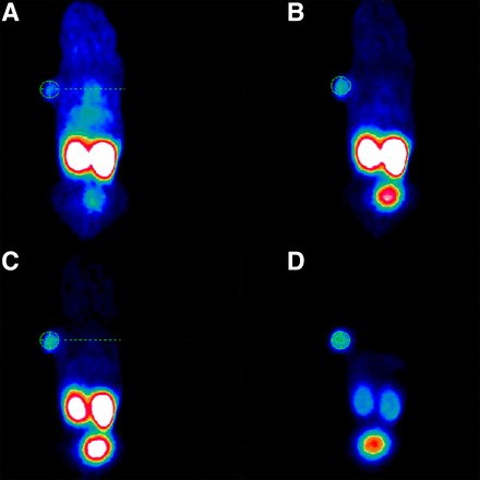 Whole-body coronal slices from small-animal PET imaging of athymic male nude mouse bearing LNCaP tumor xenografts. Tumor-targeting efficacy and pharmacokinetic properties were evaluated by injection of 0.5 nmol of 68Ga-labeled PSMA-617 (∼30 MBq) with following scans at 0–20 min (A), 20–40 min (B), 40–60 min (C), and 120 min (D) after injection.