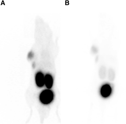 Whole-body coronal scans as maximum-intensity projections at 60 (A) and 120 min (B) after injection of 68Ga-labeled PSMA-617.